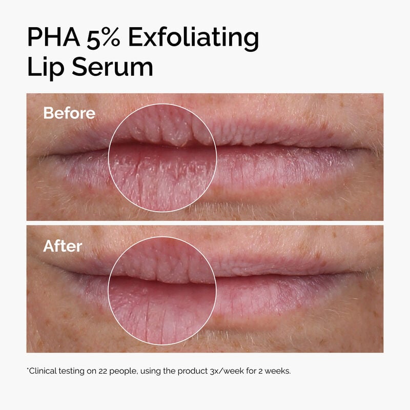 PHA 5% Exfoliating Lip Serum - 15ml