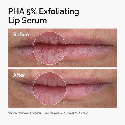 PHA 5% Exfoliating Lip Serum - 15ml